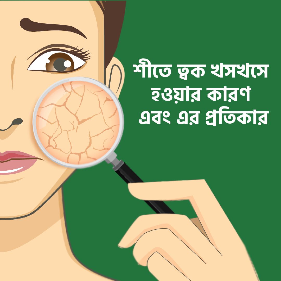 শীতে ত্বক খসখসে হওয়ার কারণ এবং এর প্রতিকার
